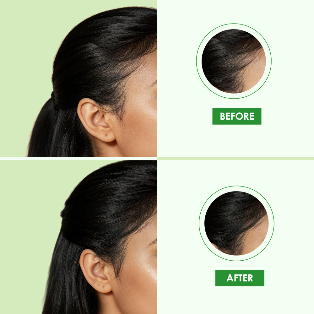 Lily Advanced Anti-Hair fall Serum Oil